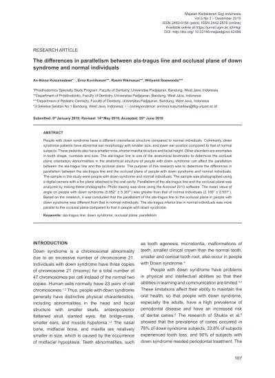 The Differences In Parallelism Between Ala Tragus Line And Occlusal