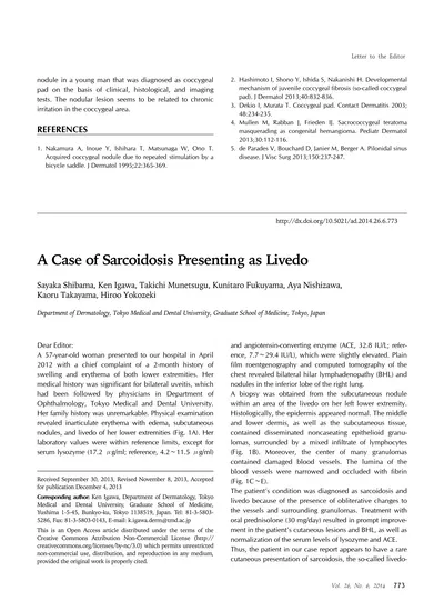 A Case Of Sarcoidosis Presenting As Livedo