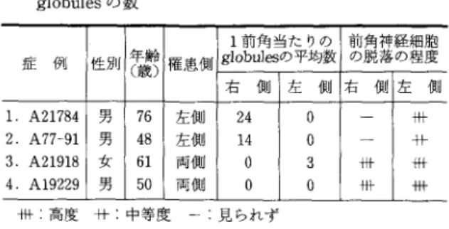 表 4 慢 性 灰 白 脊 髄 前 角 炎 の 腰 仙 髄 前 角 に 見 ら れ た g l o b u l e s の数 1 前角当たりの 前 の 脱 角 神 落 経 の 細 程 胞度 症 例 性別 年 〔 歳 齢 〕権患側 g l o b u l 自の平均数 右 側 左 側 右 側j左 側 1 .  A21784  男 7 6  左側 2 4  。 十 朴 2 