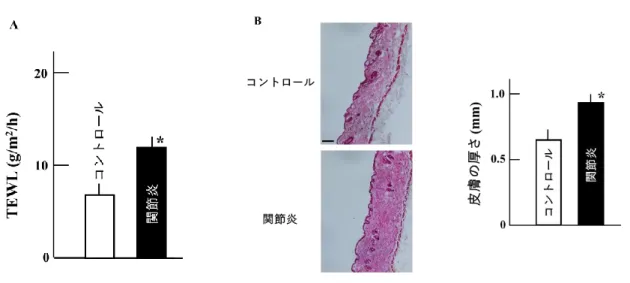 Fig. 3  関 節 炎 マ ウ ス に お け る 皮 膚 状 態 の 変 化