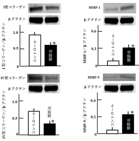 Fig. 4  皮 膚 に お け る I 型 コ ラ ー ゲ ン 、 IV型 コ ラ ー ゲ ン 、 MMP-1お よ び MMP-9 の 発 現 量 ウ エ ス タ ン ブ ロ ッ テ ィ ン グ に よ り 皮 膚 中 の I 型 コ ラ ー ゲ ン 、 IV型 コ ラ ー ゲ ン 、 MMP-1お よ び MMP-9 の 発 現 を lumino-image analyzerを 用 い て 検 出 し 、 数 値 化 し た 。 値 は β-actinに よ り 標 準 化 し 、 平 均 値 ±S