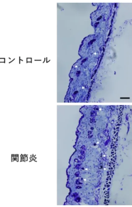 Fig. 5  関 節 炎 マ ウ ス の 皮 膚 に お け る マ ス ト 細 胞 の 発 現 数