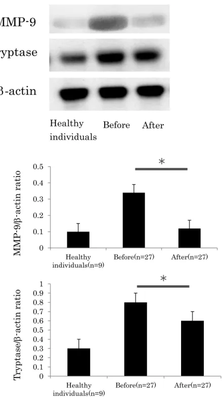 Fig. 4.    Expression of MMP-9 and Tryptase Before and After Sclerotherapy  Values  of  MMP-9  and  tryptase  in  skin  before  and  after  treatment