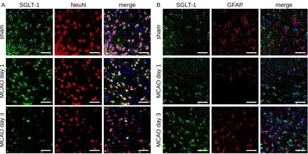 Fig. 7. Localization of SGLT-1 within neurons and astrocytes in the cortex after cerebral ischemic stress