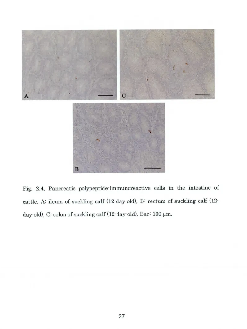 Fig. 2.4. Pancreatic polypeptide‑immunoreactive cells in the intestine of