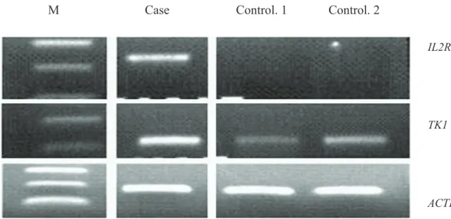 Fig. 2-2: RT-PCR analysis of IL2R (230bp), TK1 (203bp) and ACTB (187bp) genes in  lymph node tissue of case 1 (calf form BL) and two control animals