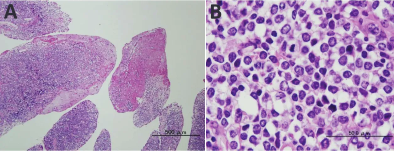 Fig. 2-4: Histopathological abnormality of the synovial membrane of the carpal joint of  case 1 (calf form BL)