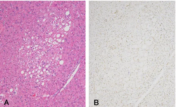 Fig. 5    Microscopic findings of clear cell foci in male B6C3F1 mice. Note reduced Cx32  positive spots in the lesion