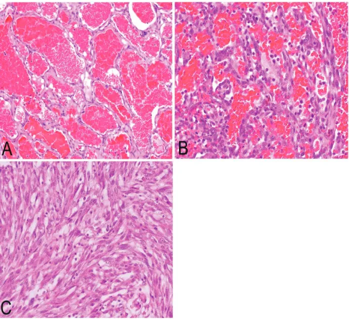 Figure 1. Histopathological features of hemangiosarcoma (HSA) and hemangioma (HA) tissues