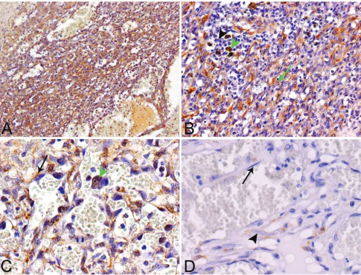Figure 3. Detection of urokinase plasminogen activator (uPA) and uPA receptor (uPAR) in canine HSA  and HA tissues