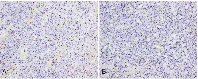 Figure 4. Immunohistochemical analysis of Ki-67 in canine hemangiosarcoma (HSA) and cutaneous  hemangioma tissues (HA)
