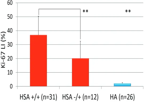 Figure 5. Summary of the average Ki-67 LIs for uPA+/uPAR+ HSAs, uPA-/uPAR+ HSAs, and HAs