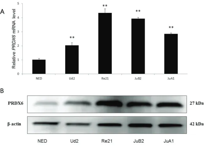 Figure 8. Analysis of PRDX6 expression in normal endothelial cells (NED)and HSA cell  lines by real-time reverse transcription-PCR (A) and western blotting (B)