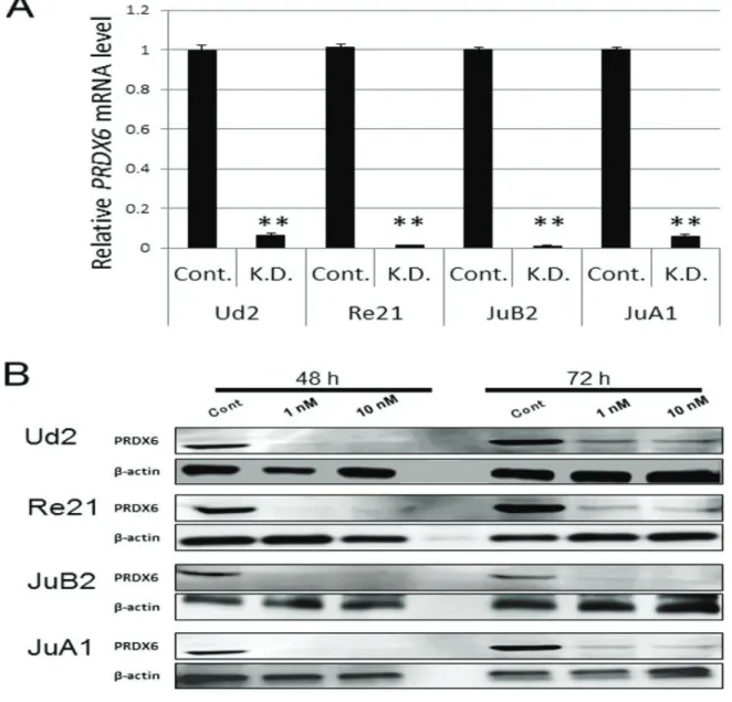 Figure 9. PRDX6 knockdown by siRNA in HSA cell lines (Ud2, Re21, JuB2, and JuA1). 