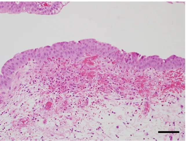 Fig. 4    Microphotograph of the urinary bladders of a male SD rat treated with BITC at a dose of  800 mg/kg × 2