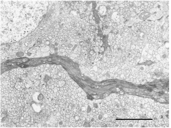 図 10  プルキンエ細胞樹状突起，超微形態像， Bar = 4 µm ，生後15日，罹患ウサギ No.7。走行が不整で湾曲して いる樹状突起が観察される。                                                                         