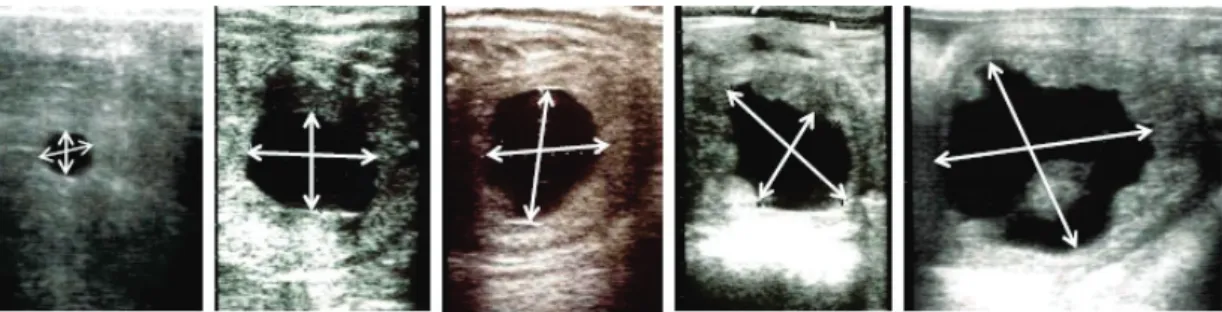 Fig. 2-1.  Measure of embryonic vesicle diameter. 