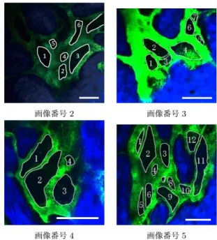 図 3 図 1 への前景ストロークの輝度の分布