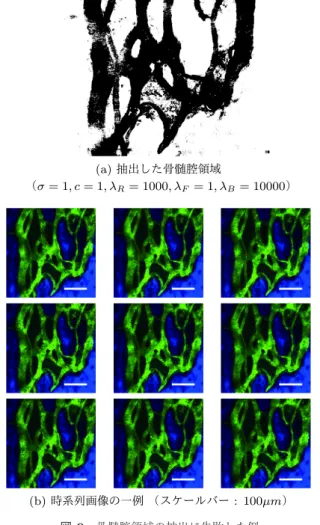 図 9 骨髄腔領域の抽出に失敗した例