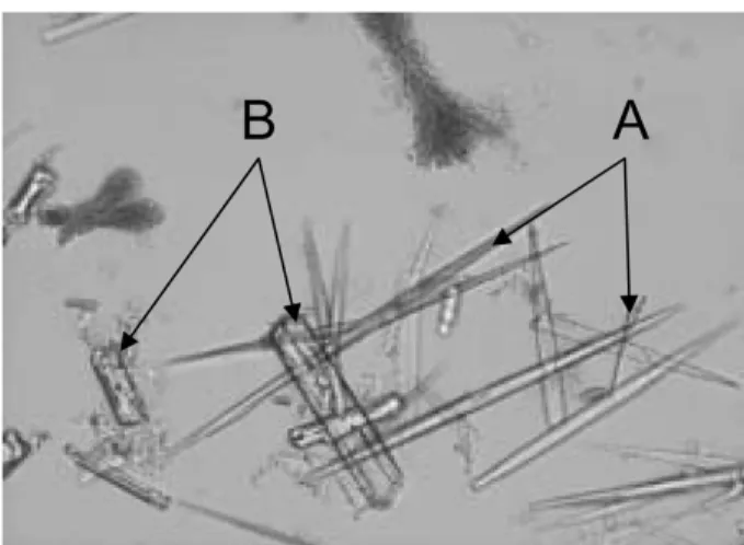 Fig. 3. Urine sediments of the affected calf. A: Orotic acid crys- crys-tals, B: struvite crystals.