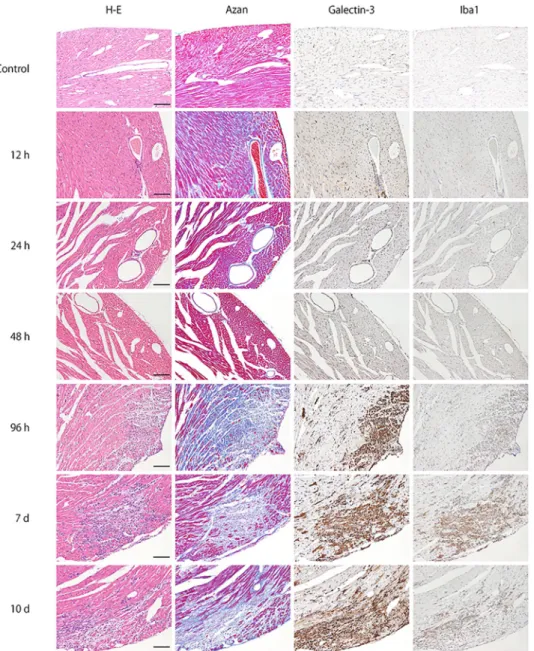 Fig 1. Time-course of representative microphotographs of H&amp;E staining, Azan staining for fibrotic lesions, and immunohistochemistry for galectin-3 and Iba1 in heart tissues at 0, 12, 24, 48, 96 hours, 7 and 10 days after intraperitoneal inoculation of 