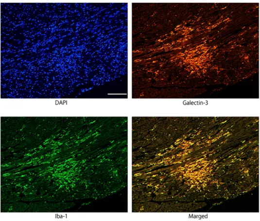 Fig 2. Immunofluorescence images confirming the co-localization of galectin-3 and Iba1 immunoreactivity in activated macrophages/histiocytes in myocarditis lesion 96 hours after EMCV inoculation