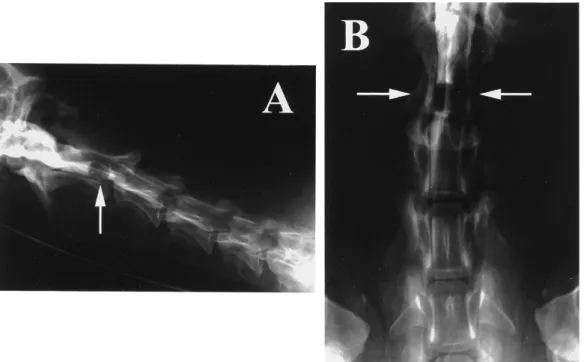 Fig. 1. Lateral (A) and ventrodorsal (B) myelograms of the cervical region of the patient