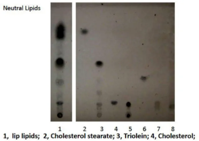 Fig. 2 shows typical TLC pattern of lip lipids extracted with EPI solvent, and the lip lipids contained mainly  hydrocar-bons, squalene, cholesterol ester, triglycerides, free fatty acids, free cholesterol, diglycerides, and polar lipids