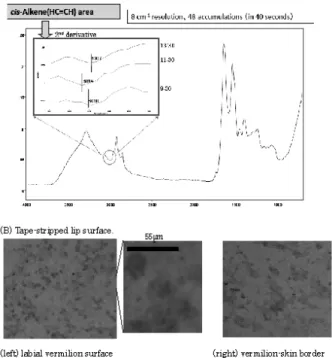 Fig. 5 shows changes of DRI values for age 20s (n = 12 × 3; twelve persons and three measurements) and 60s (n = 6 × 6; six persons and six measurements) with DHA diet and control (soy oil) diet