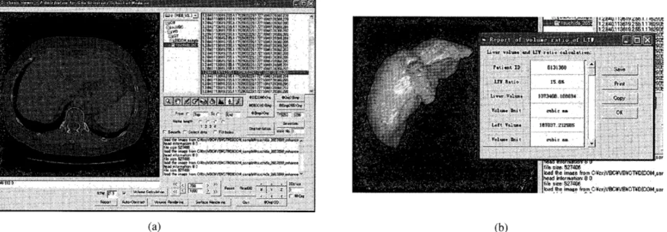 Fig, 12 {a) is the user interface that enab]es doctors to  segment liver  region; calculate liver area; view