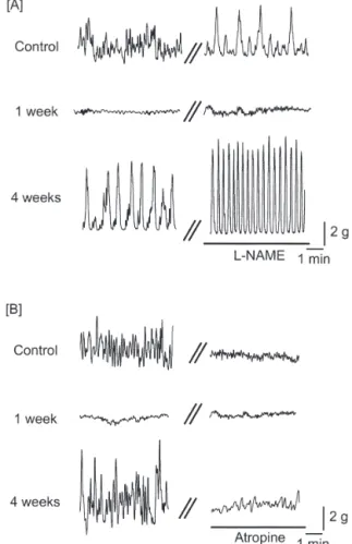 Fig. 2 Representative  traces  of  spontaneous  contractions  in  the  control  and TNBS-treated  hamster  distal  colons  at  1  week  or  4  weeks