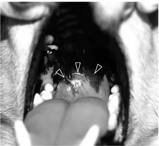 Fig. 1. Photo of the oral cavity at 1st admission. Remarkable swelling of the soft palate is observed ( ).