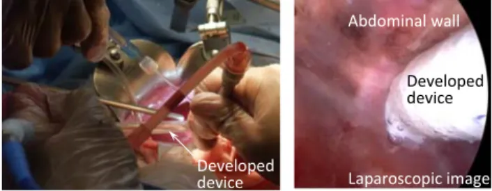 Fig. 23 Antenna for capsular endoscope.