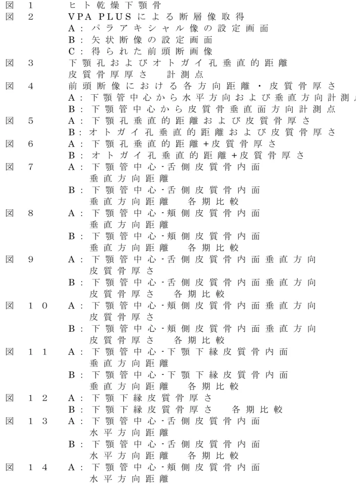 図 の 説 明 図 １   ヒ ト 乾 燥 下 顎 骨 図 ２   V P A   P L U S に よ る 断 層 像 取 得   A ： パ ラ ア キ シ ャ ル 像 の 設 定 画 面           B ： 矢 状 断 像 の 設 定 画 面           C ： 得 ら れ た 前 頭 断 画 像 図 ３   下 顎 孔 お よ び オ ト ガ イ 孔 垂 直 的 距 離 皮 質 骨 厚 厚 さ   計 測 点 図 ４   前 頭 断 像 に お け る 各 方 向 距 離 ・ 皮 