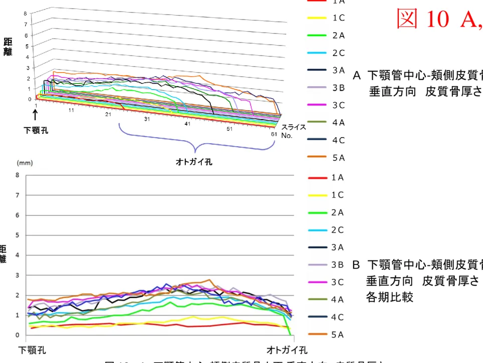 図  10  A,B  A  B  A   下顎管中心 - 頬側皮質骨内面    垂直方向  皮質骨厚さ  B   下顎管中心 - 頬側皮質骨内面     垂直方向  皮質骨厚さ       各期比較 図 10   A  下顎管中心-頬側皮質骨内面 垂直方向  皮質骨厚さ              B  下顎管中心-頬側皮質骨内面 垂直方向  皮質骨厚さ  各期比較 