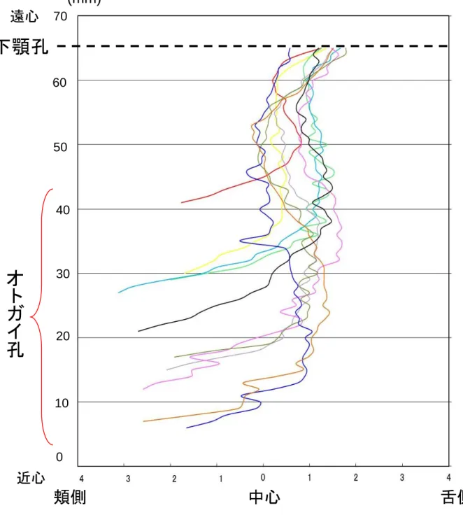 図 15  下顎管前方成長  各期比較  図  15 オトガイ孔下顎孔頬側                            中心                            舌側 70 60 50 40 30 20 10 0 遠心 近心 １A １C ２A ２C ３A ３B ３C ４A ４C ５A (mm) (mm) 