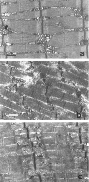 Fig. 4. Electron micrographs of the tibialis anterior muscle. 