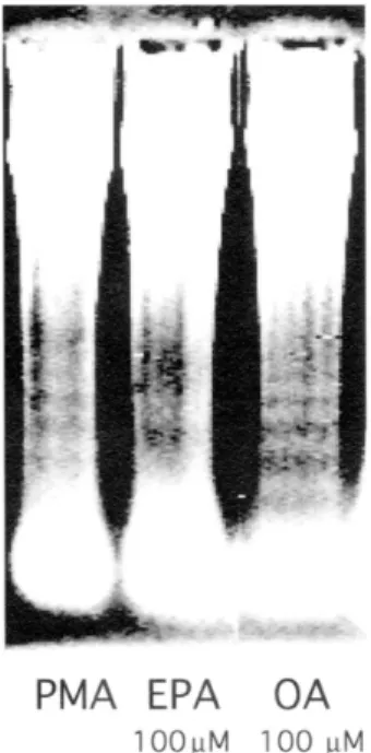 Fig. 2. Under a fluorescent microscope, nuclear contraction  and  the  typical  apoptotic  cell  (A)which  carried  out  the  dark stain were detected after 24 hours additing 100 μ M   oleic acid (OA) and EPA by Hoechst 33258 stain (original  magnification