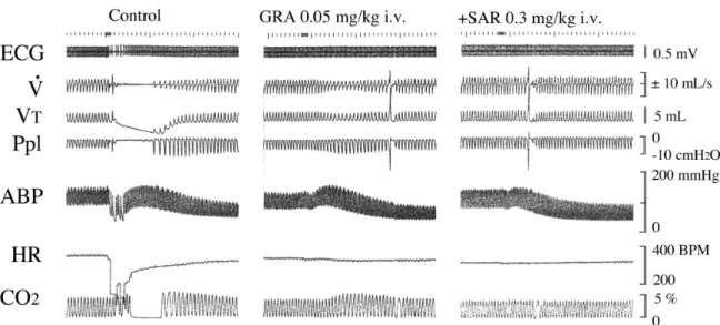 Fig. 4.  Effects of granisetron (0.05 mg/kg) and sarpogrelate  (0.3  and  1.0  mg/kg)on  5- HT-induced  decrease  of  lung  conductance  and  compliance