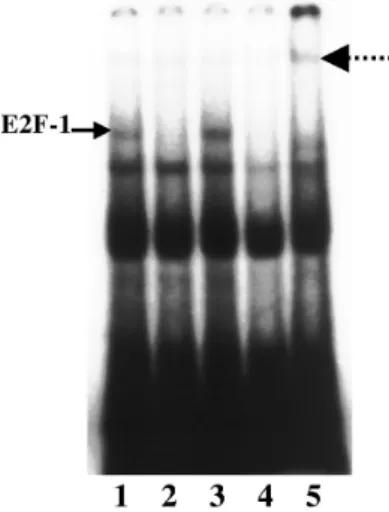 Fig. 6. Electorophoretic moility shift assay showed enhanced  E2F - 1 DNA binding activity in FRTL - 5 cells transfected  with survivin sense gene (lane 3) as compared with cells  transfected  with  an  empty  vector  (lane  1)  or  a  sur vivin  antisense