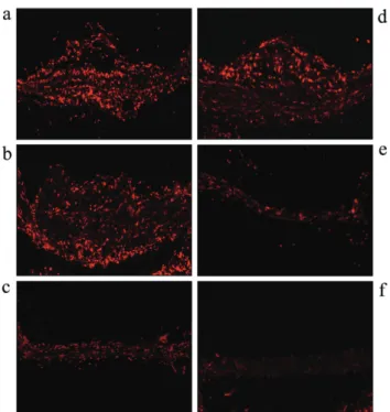 Fig. 5. Effect of olmesartan and estrogen on NADPH oxidase  activity in ApoEKO mice. Protein samples were prepared  and NADPH oxidase activity was measured as described in 