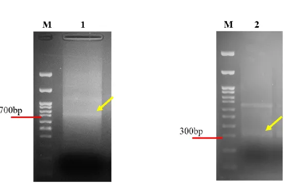 Fig. 2-5 Electropherogram of STRF3’H1 gene 5’RACE. 
