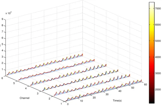Fig. 3. Comparison of dynamic EEG energy for a healthy subject, comatose patient and brain death.