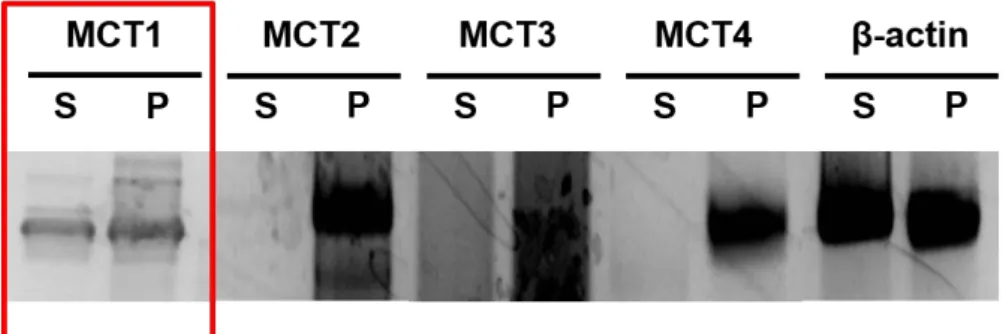 Fig. 4    RT-PCR analysis of the mRNA expression of monocarboxylate transporters (MCT1~4) in  HEK/eLuc cells  2