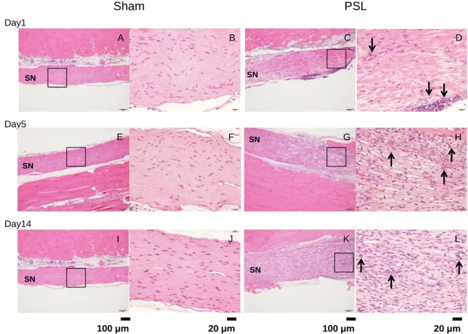 Figure 8    HE staining of the sciatic nerve in sham and PSL mice. 