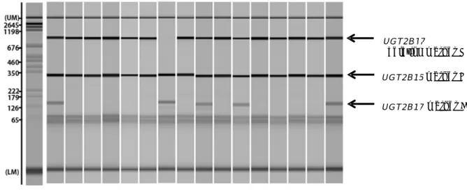 Figure 1 UGT2B 増 幅 の 有 た 31) 。 UGT2B 物 （ ma UGT2B れ る 。 は UGT た め の 指 1-4. Typica17 遺 伝 子 型有 無 を 用 い。17遺 伝 子 がarker D） が17欠 失 点UGT2B17 をT2B15のex指 標 と し た3’       mdi dd l electropho(marker J:型 は 、3 つ のい て 判 定 しFigureが 存 在 し てが 検 出 さ れ る（UGT2B15を 欠 失 し てxon