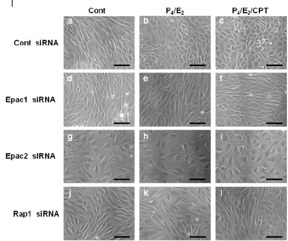 Figure  6.  Epac1,  Epac2  or  Rap1  knock-down  inhibits  ovarian  steroid-induced  functional  and  morphological decidualization 