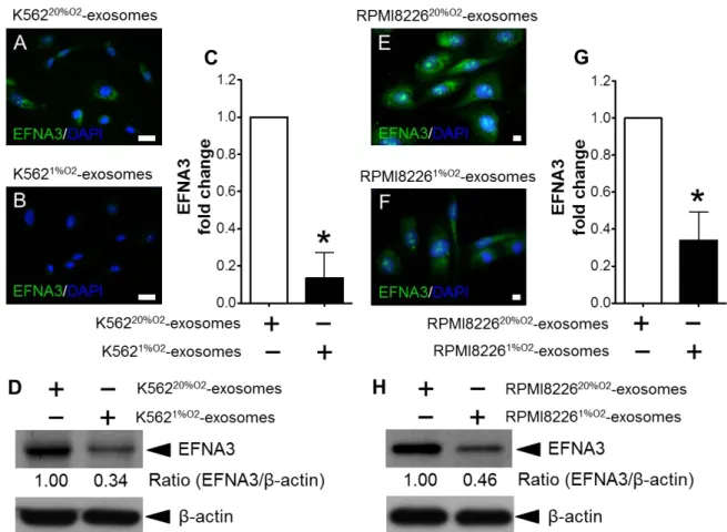 FIGURE 5. EFNA3 expression of HUVECs cultured with exosome derived from K562  cells. (A, B) EFNA3 expression was inhibited by exosomes derived from hypoxic  K562 cells
