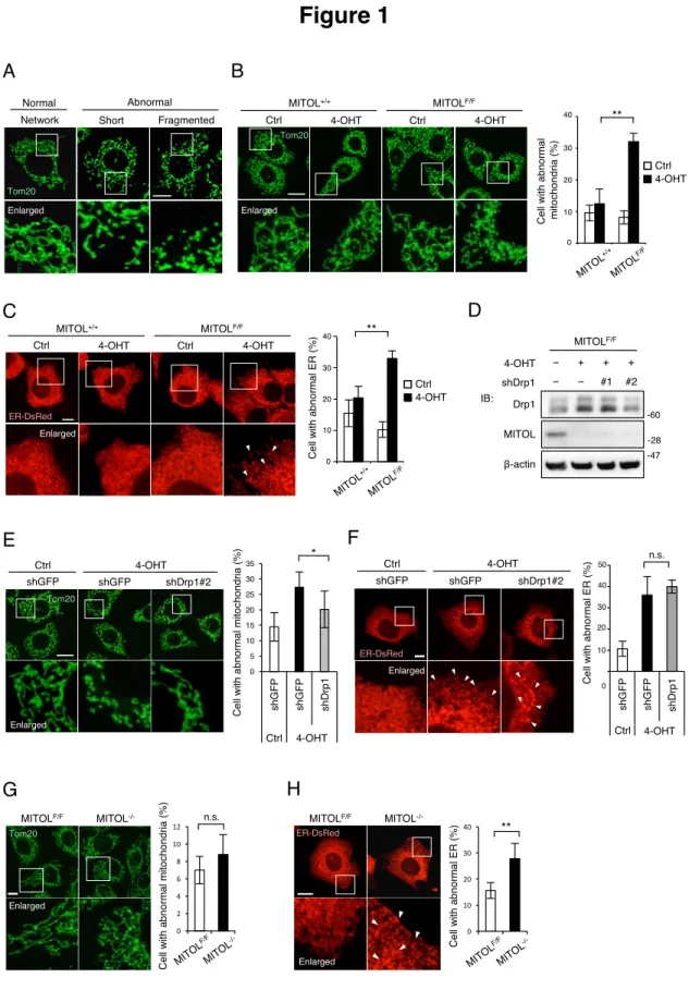 Figure 1  Tom20 Enlarged shGFPCtrl 4-OHT shDrp1#2shGFP Enlarge shGFPCtrl 4-OHT shDrp1#2shGFPER-DsRedEnlargedCtrlMITOL+/+MITOLF/FTom20EnlargedCtrl4-OHT4-OHT 00.10.20.30.4 MITOL+/+ MITOLF/F**102030400 4-OHTCtrl