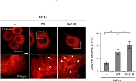 Figure 10 WT K481R− EnlargedER-DsRed 00.20.40.6 Vec WT K481R